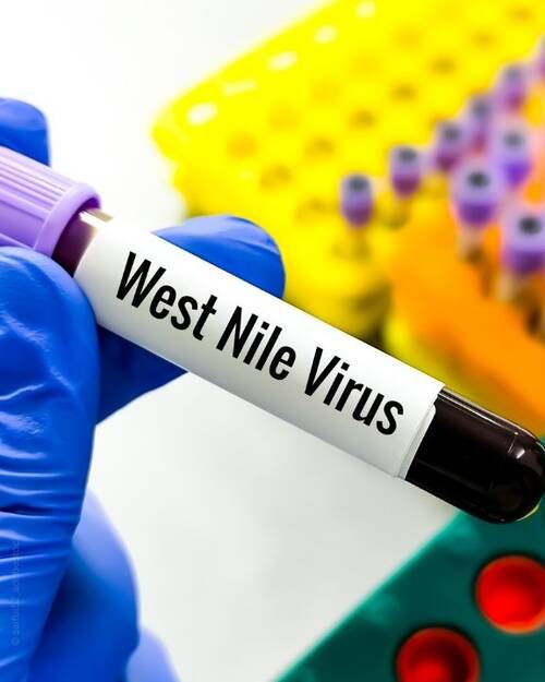 West Nil Virus 1
